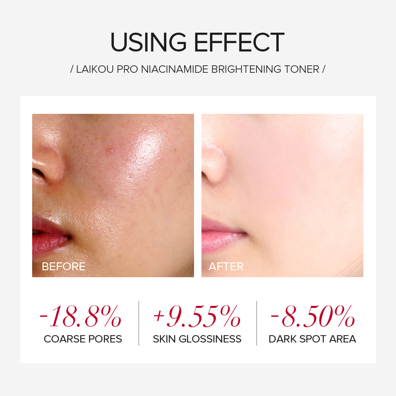 Ensemble de soins éclaircissan - Niacinamide Brightening Serum avis et prix