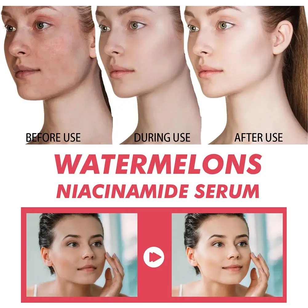 Sérum hydratant à la pastèque  - Niacinamide Brightening Serum avis et prix