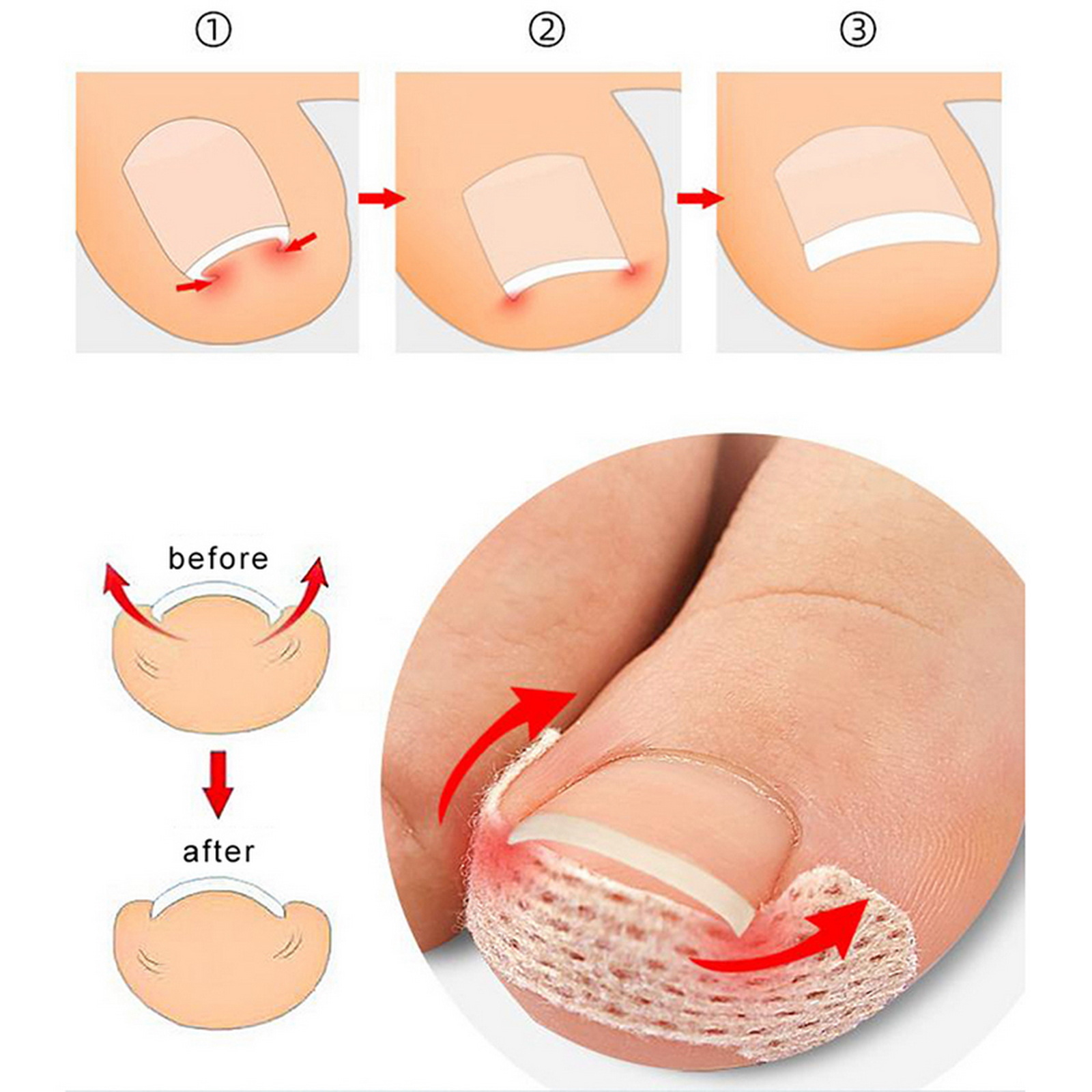 10-100 Pièces Patch Adhésif po - Skincare Oily Skin avis et prix