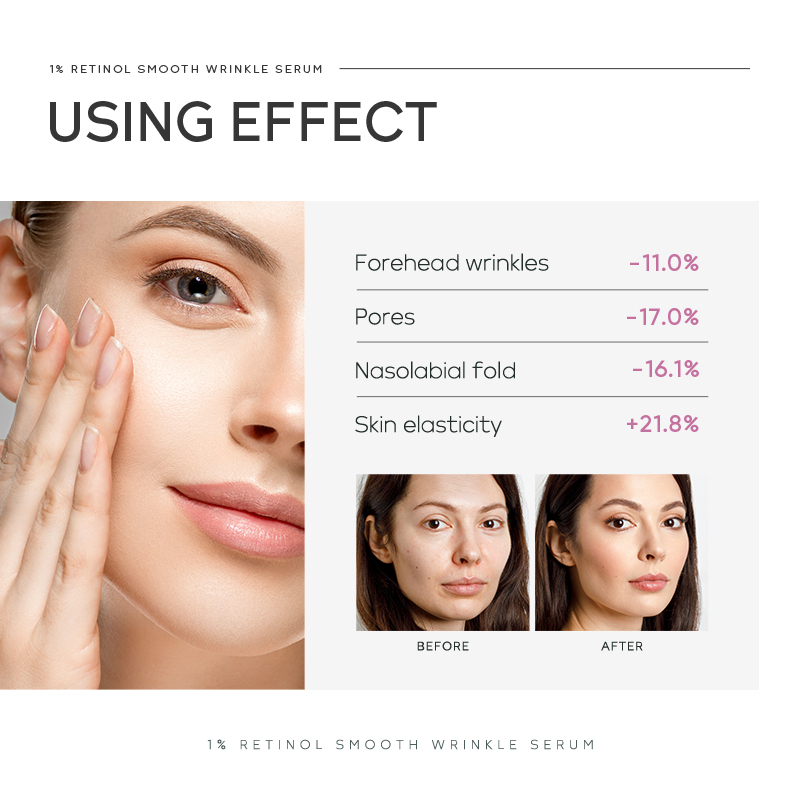 Sérum lissant anti-rides Quiyu - Niacinamide Brightening Serum avis et prix